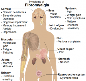 Symptoms_of_fibromyalgia