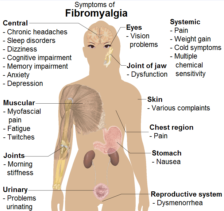 An Overview Of Fibromyalgia My Fibromyalgia Diet
