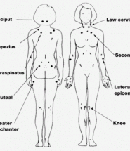 Diagnostic Criteria For Fibromyalgia