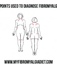 18 Points Used to Diagnose Fibromyalgia
