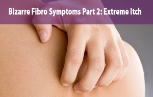 Bizarre Fibro Symptoms Part 2- Extreme Itch